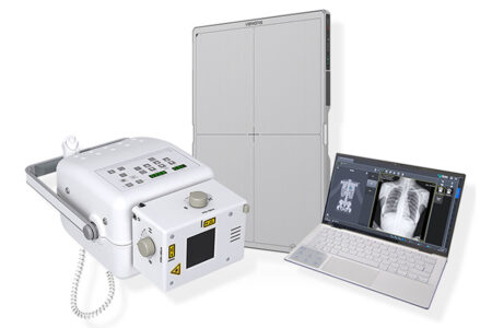 sistema radiologico portatile per esami a domicilio