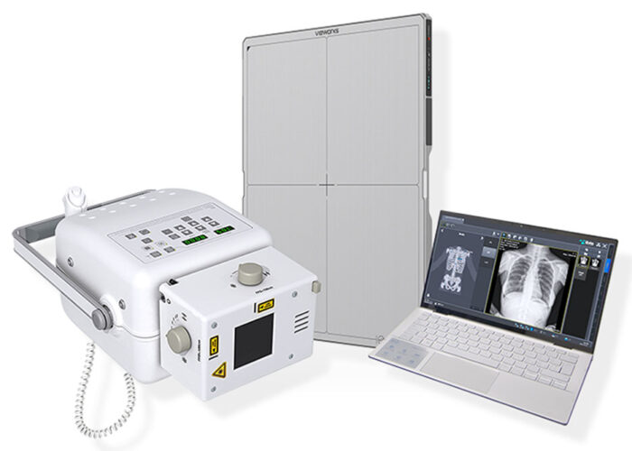 sistema radiologico portatile per esami a domicilio