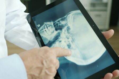 Come scegliere un generatore RX per la radiologia domiciliare
