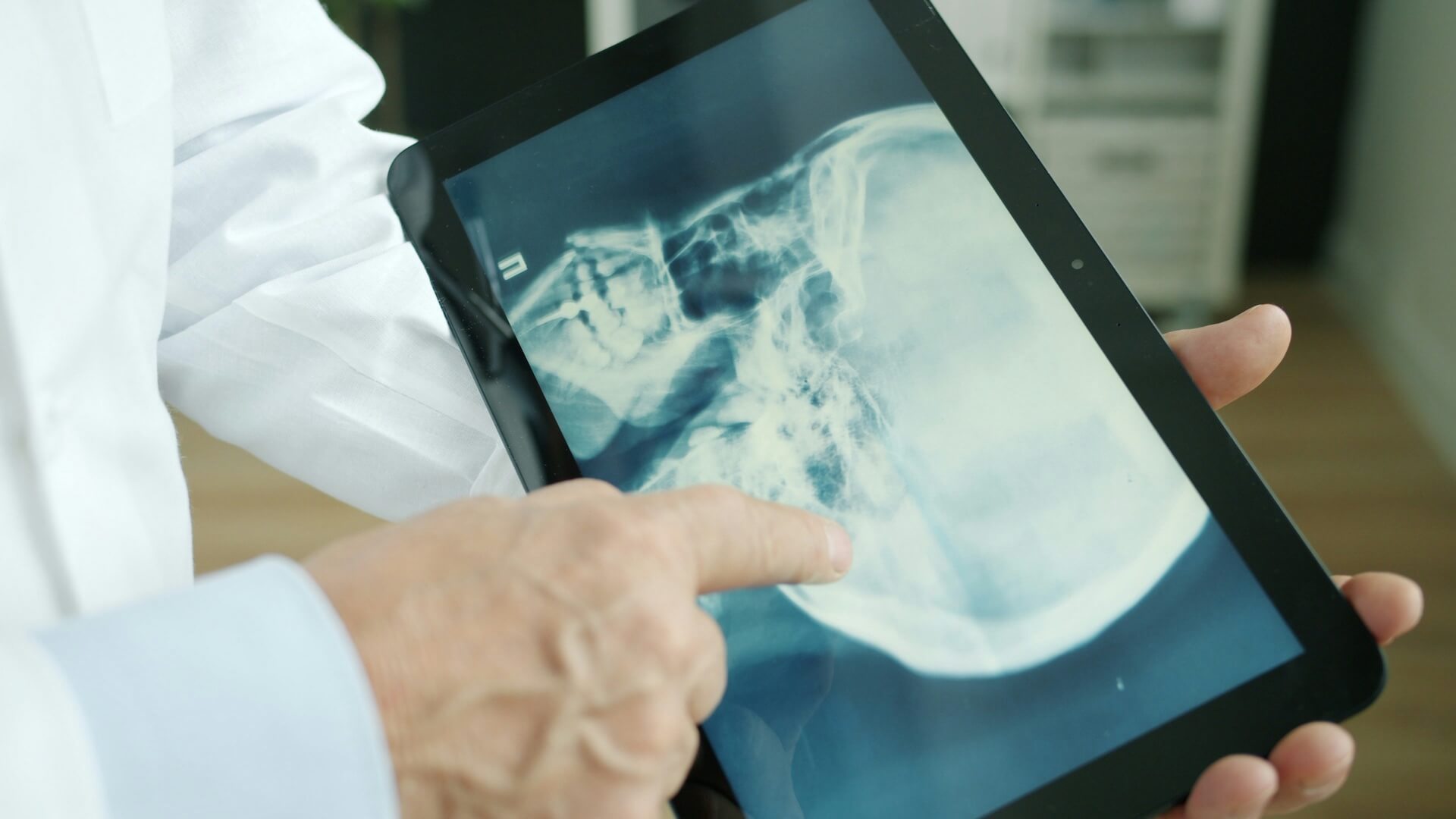 Come scegliere un generatore RX per la radiologia domiciliare
